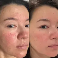 フェイシャルワックス✖️韓国肌質改善🇰🇷顔全体引き上げる✨つるスベ肌に🥚