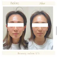 【初回】頭蓋骨小顔セラピア