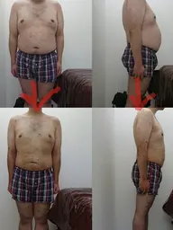 120分×（3回来店）マシン痩身がっつりサイズダウン短期集中コース