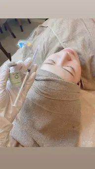 【大好評美肌維持❤️🔥⤴️】圧倒的ツヤ☆自発光最新ピーリング『WIQо水光ピール🫧』¥9,800