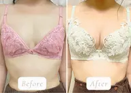 写真モニター価格【痩せたデコルテボリュームUP】上半身マッサージ＋豊胸マシーンお試し¥9,900