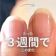 自爪育成[ジェル育成]