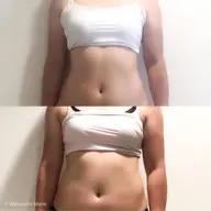 骨格矯正ロミロミ×ホットストーン、頭から足の先までたっぷり120分コース