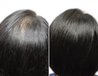 増毛エクステ500本(カウンセリング込)