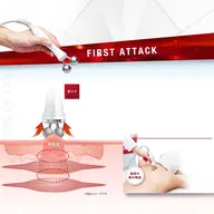 【ウルトランスフォーマーで辛い肩周りのハリにアプローチ】筋膜リリース首肩周り