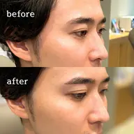 【ミニモ限定＊】メンズ眉毛スタイリング[WAX脱毛] #五反田#メンズ眉毛#モテ眉※口コミ必須