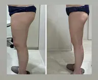 足痩せ集中メニュー🦵納得の結果出し😊どんな服でも着こなせるシンデレラボディへ✨