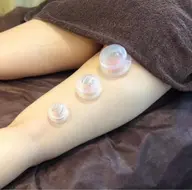 💥カッピング 全身45分💥全身浮腫ケア/筋膜リリース