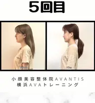 【当院人気NO.2クーポン！！】頭蓋骨・小顔矯正+骨盤矯正￥12,000円→4500円！！