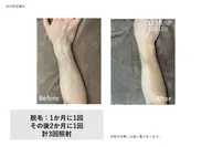 両腕(甲・指込み)セット