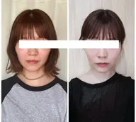 小顔効果抜群！エンドリングフェイシャル®︎ クイックコース