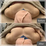 【新規限定】バストUP♡上半身丸ごと美シルエット！自信のデコルテバストライン♥️最新機器NRプリンセスバスト♡スペシャル