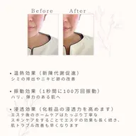 【美大生限定】超音波小顔エステ