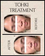 【REVI 陶肌トリートメント】+生酵素パウダーで毛穴汚れを取り除き明るいなめらか肌を体感🫧