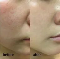 【相談】してからメニューを決めたい方 ※補足説明を必ずご覧頂いてからご予約お願いします🙇‍♀️