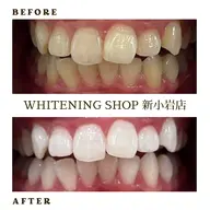 💎ミニモ学割U24割💎美白ホワイトニング 20分✕10回照射¥ 26,400→¥19,800