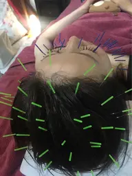 人気です❣️最強美肌100本コース🧡