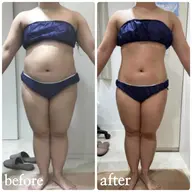 くびれが欲しい、下っ腹をなくしたい！そんなあなたにオススメ‼️セルライト吸引でスッキリお腹に✨