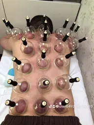 酵素風呂+カッピング吸玉  90分¥8000 →¥6000