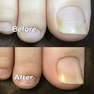 かかとツルツル☆ドイツ式フットケア60分