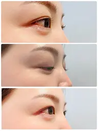 人気No.1 パリジェンヌラッシュリフト✨根元からぱっちり立ち上げでビューラーいらず♡【コーティング付】