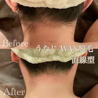 後ろ姿美人に♡WAXうなじ脱毛（¥2980）