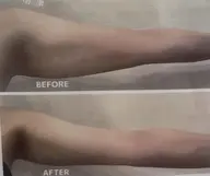 二の腕肩甲骨をスッキリさせ、二の腕美人へ✨引き締まったボディラインを！自分では出来ない二の腕肩甲骨ケアぜひお任せ下さい！