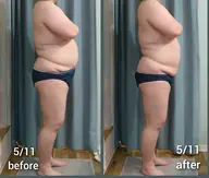 60分ボディ【デトックスコース】疲労・むくみ・ダイエット・体質見直しなど❗お悩みに合わせた施術をします♪♪