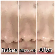 【新規/透明感爆上げ・春の毛穴ケア】全顔3D毛穴洗浄＋美容液うるおい浸透ケア¥12,200