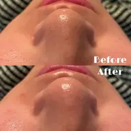 【先着20名様限定】毛穴スッキリ洗浄体験✨