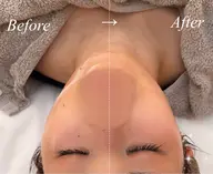 【顔の小ささに驚き‼️】                                    即効小顔エステ😳