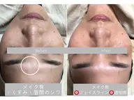 日頃の疲れを癒したい方必見❗️デコルテ付き泥フェイシャルエステマッサージ🍂期待以上、お値段以上のエステ内容です❗️