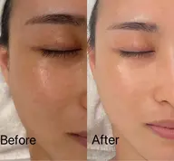 フェイシャルコルギ60分