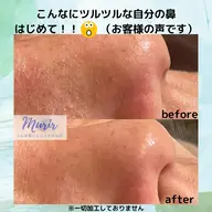 【学割】2番人気！毛穴集中改善エステ80分＋カウンセリング60分お土産付♪