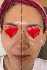 AI肌分析の後、お悩みに合わせたお手入れ方法の提案。一緒に毎日のお手入れを見直ししませんか？