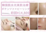 ポテンツァ×ピーリング