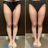 【キャビゼロ】40分　下半身✨気になるボコボコやむくみを除去！理想の美脚へ