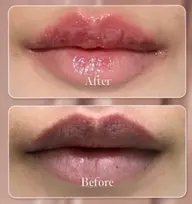 韓国で話題✨ルメラ 唇