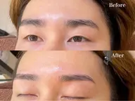 メンズ限定✨【学割🧑‍🎓】ワックス脱毛💖