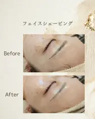 【学割U24】つるすべフェイスシェービング