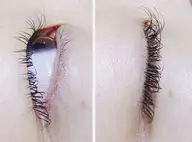 🔷🔶フラットラッシュ 100本+育毛トリートメント(アイシャンプー・オフ込み)🔶🔷