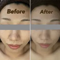 【お写真必須クーポン】フェイシャルエステのBefore After撮影にご協力いただける方へ☆お顔のリンパをお流し◎
