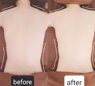 ☆お試し☆癒されながらW痩身!炭酸×キャビテーション60分¥15000→¥10000