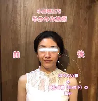 むくみ撃退、歪み改善！！小顔矯正