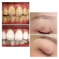 眉毛デザインワックス脱毛🍯＋高濃度ジェルホワイトニング🌿30分照射