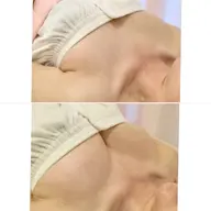 【上向きバスト・魅せるデコルテ】高さと丸みを引き上げて胸元を華やかに