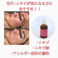 🌿REVIハーブピーリング🌿➕【高濃度ビタミンC美容液】