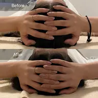 特別割引♡頭蓋骨小顔矯正