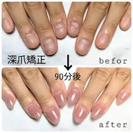深爪矯正（オフなし）スカルプ+ワンカラーorラメグラ+ネイルケア+ネイルオイルプレゼント