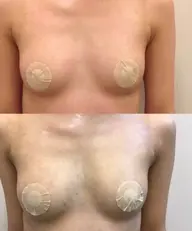 【人気No.1★全身ケア】憧れのふるふわ谷間へ♪極上バストアップエステ(100分)【お試し体験価格】